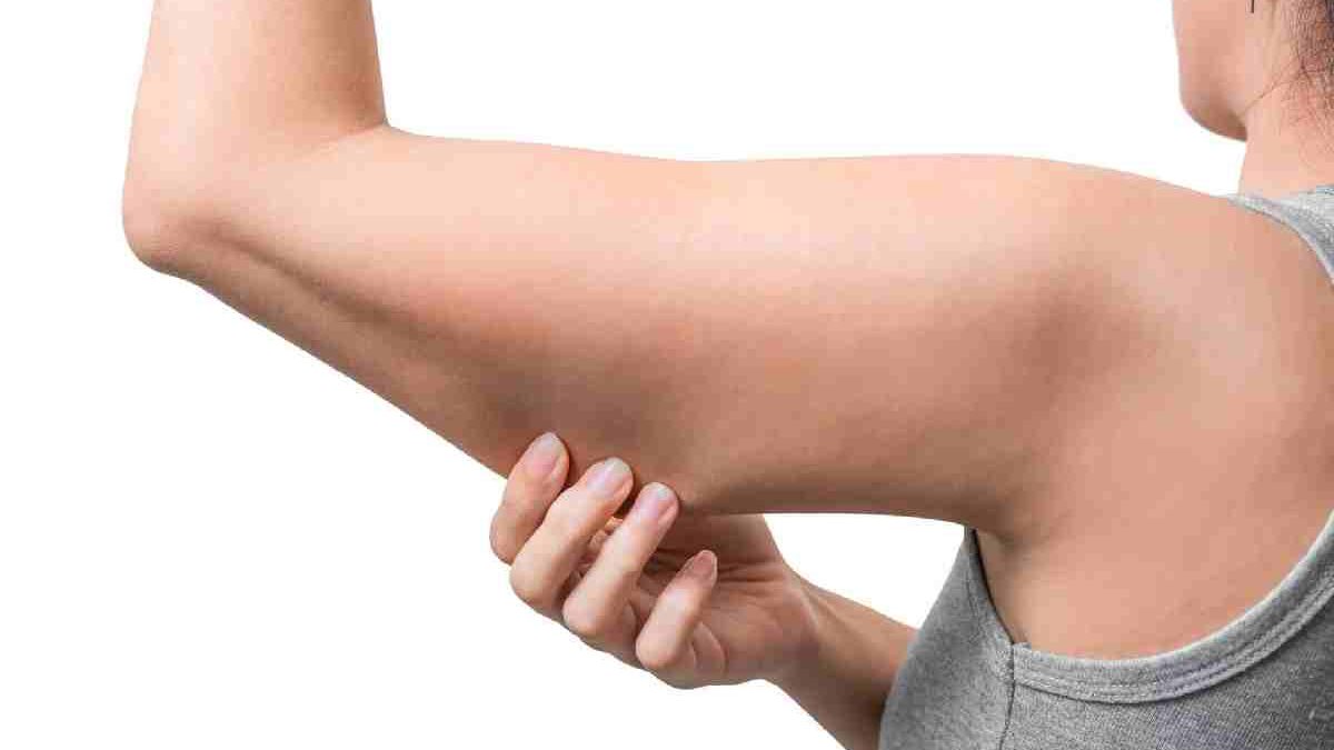 How to Lose Arm Fat?